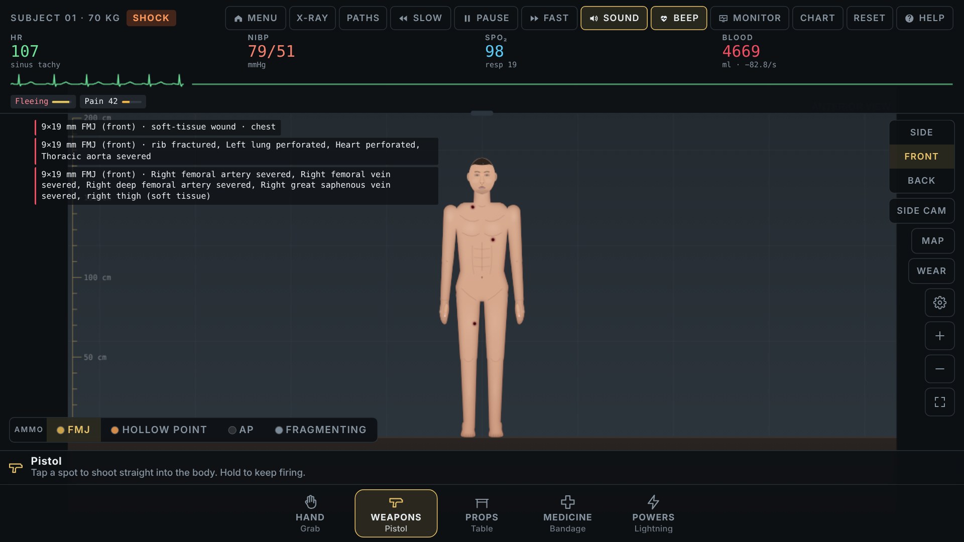 Trauma Lab monitor and event log showing changes after a Sandbox action