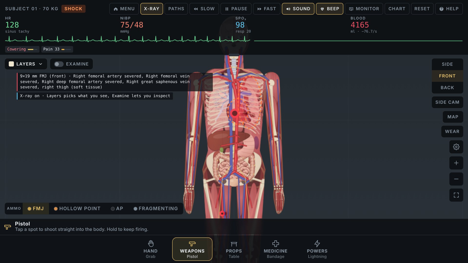 Trauma Lab X-ray view revealing the skeleton, organs, and blood vessels